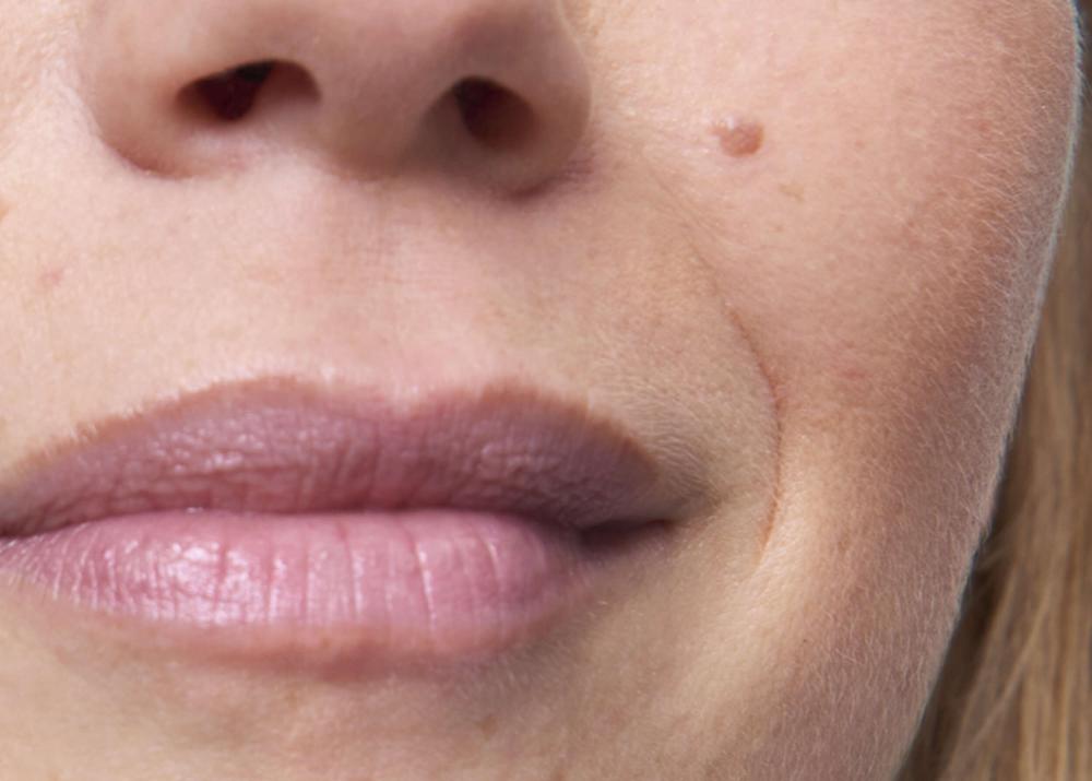 Piel de mujer con líneas de expresión al rededor de los labios